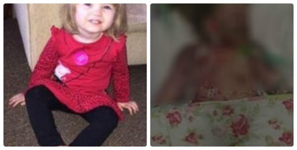 Cái chết của cô bé 2 tuổi vì viêm màng não cảnh tỉnh nhiều cha mẹ